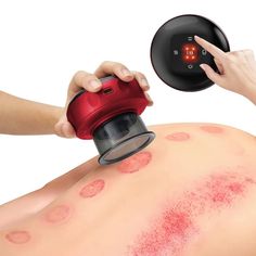 Smart Cupping Therapy Set 4-in-1 Rechargeable Electric Massager